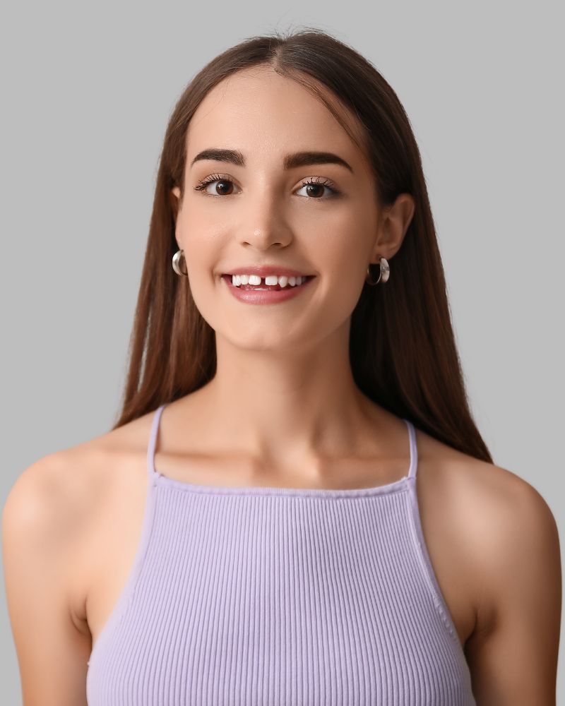 inestetismi sorriso